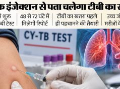 हिमाचल के अस्पतालों में शुरू हुआ CY-TB टेस्ट, टीबी संक्रमण का खतरा पहचानने में मिलेगी मदद